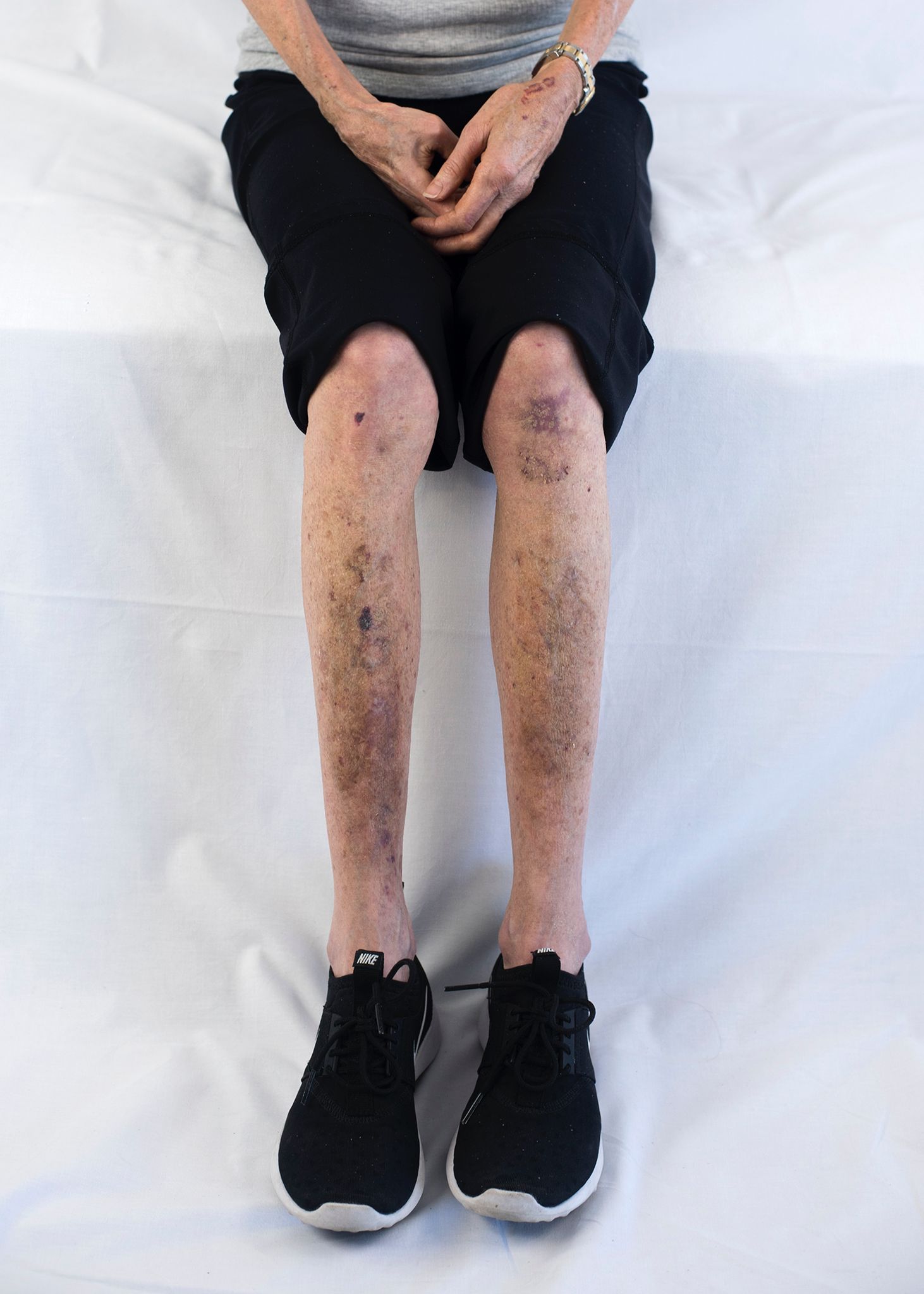 Medical Conditions