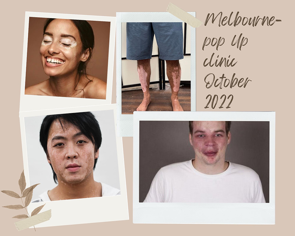 Coming To Melbourne Oct 2022